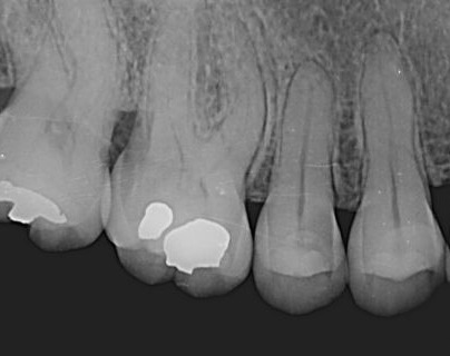 Tu Imagen Radiografías Dentales